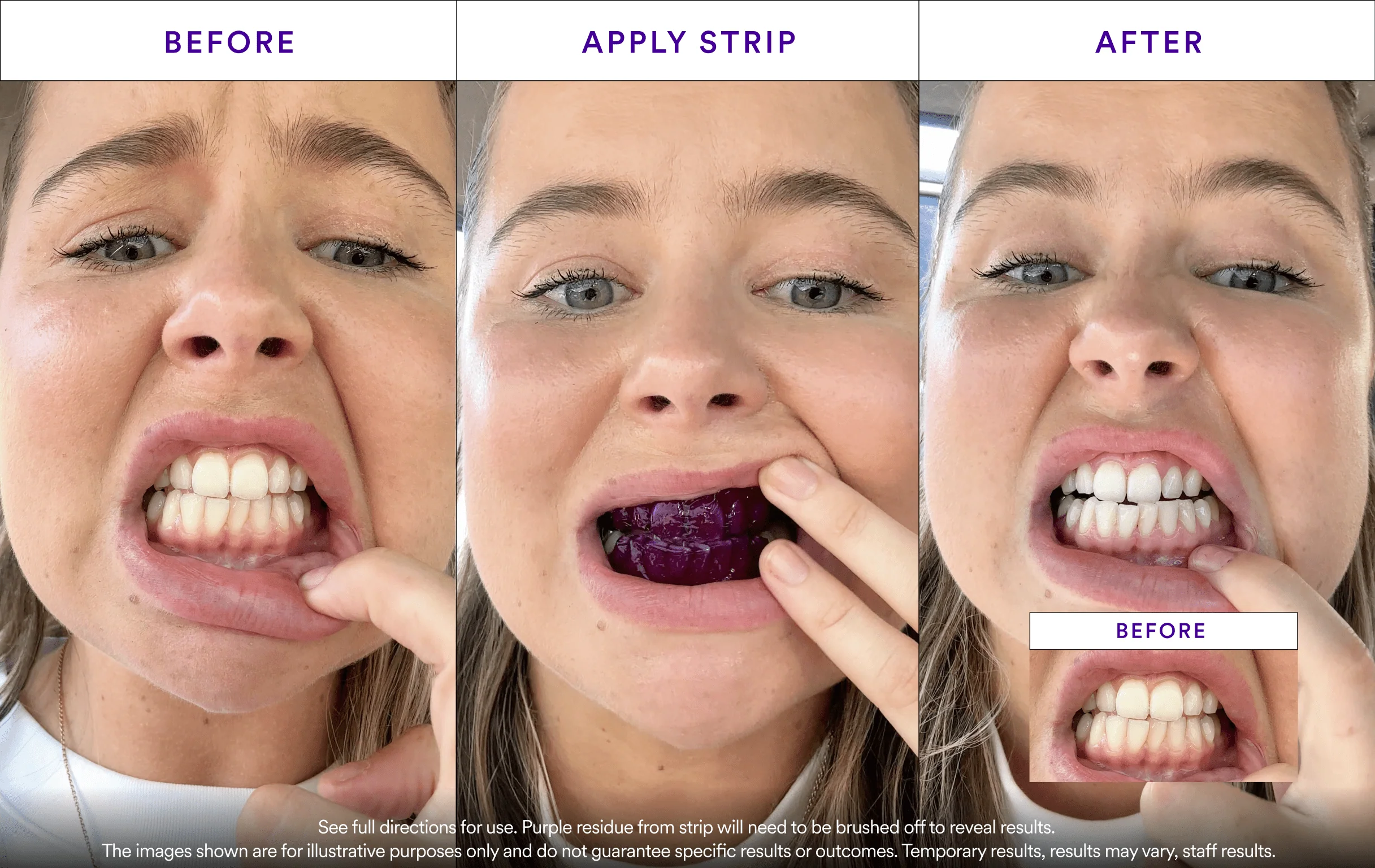 Affordable Whitening Set - Image 6